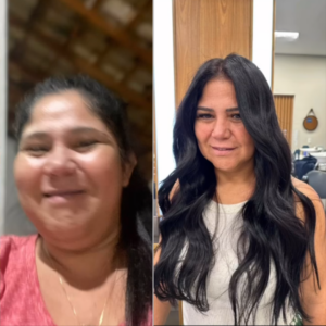 Antes e depois de Daine Rosa